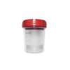 Posuda za urin, sterilna, 150 ml